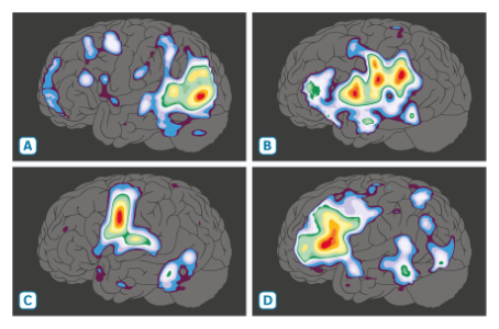 Four fMRI brain scans with colorful heatmaps visualizing language processing areas A, B, C, and D in the human brain.